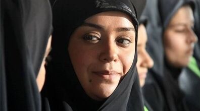 تغییر چهره ناگهانی و عجیب الهام چرخنده | چه بر سر الهام چرخنده آمد + عکس های باورنکردنی