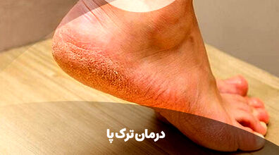 برای درمان خشکی و ترک پا، این ترکیب خونگی معجزه می کنه! + فیلم