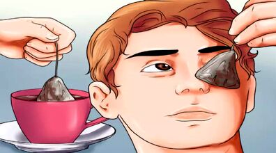 تمرین های تقویت چشم | تا حالا ورزش چشم کردی؟