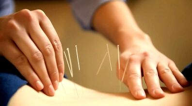 طب سوزنی واقعا درد را کاهش می‌دهد؟ 