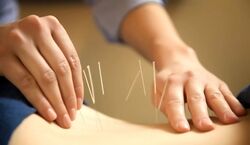 طب سوزنی واقعا درد را کاهش می‌دهد؟ 