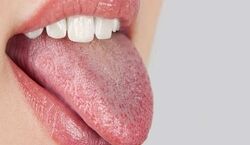 رنگ زبانت رو بگو؛ تا بگم بدنت چه مشکلی داره!!