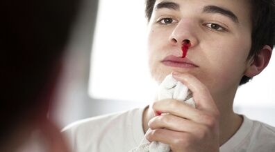 چه زمانی خون دماغ شدن خطرناکه؟ + روش بند آمدن