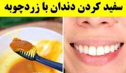 با زردچوبه مسواک بزن! | روش سفید کردن دندان با زردچوبه 