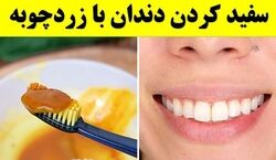 با زردچوبه مسواک بزن! | روش سفید کردن دندان با زردچوبه 