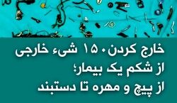 کشف ۱۵۰ شی از شکم بیمار | از پیچ و مهره تا دستبند +عکس