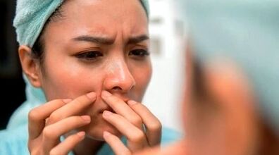 خوراکی هایی که باعث میشن پوستت جوش بزنه!
