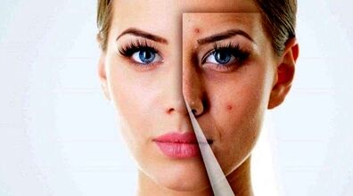 اگه جای جوش و لک داری حتما ببین! | پاکسازی صورت با روش های خانگی + فیلم