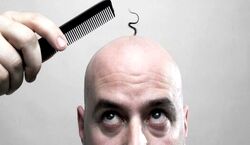 اگه این قسمت از موهات میریزه؛ قراره سکته کنی!!! | عوارض جدی ریزش مو 