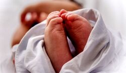 به دنیا آمدن نوزاد 2 سر در قم + عکس