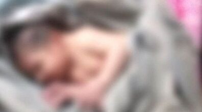 تولد نوزاد عجیب با پوستی بنفش و ۲۴ انگشت! + عکس
