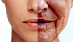 10 ماسک صورت خانگی برای رفع چین و چروک؛ از زیر هزینه های بوتاکس در برو!