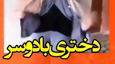  دختر عجیب الخلقه ایرانی که یک سر در ناحیه کمرش دارد + فیلم