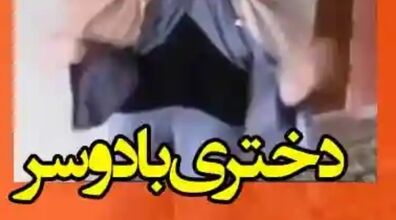  دختر عجیب الخلقه ایرانی که یک سر در ناحیه کمرش دارد + فیلم